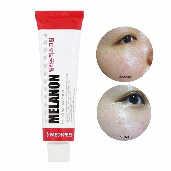 Balinošs krēms pigmentācijas novēršanai | Medi-Peel Melanon X Cream