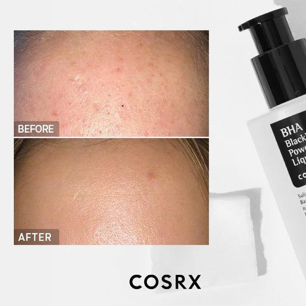 COSRX - AHA/BHA Clarifying Treatment Toner