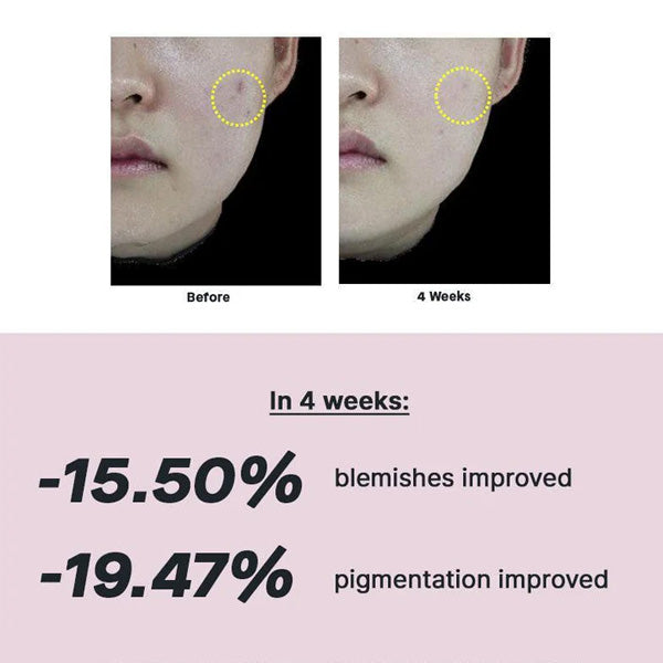 Serums ar 15% niacinamīdu | COSRX The Niacinamide 15 serum
