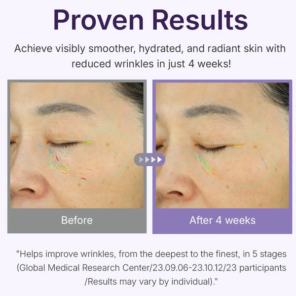 Centellian24 - 360º PDRN aktīvais serums sejas ādas atjaunošanai