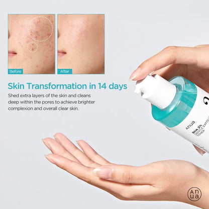 COSRX - AHA/BHA Clarifying Treatment Toner