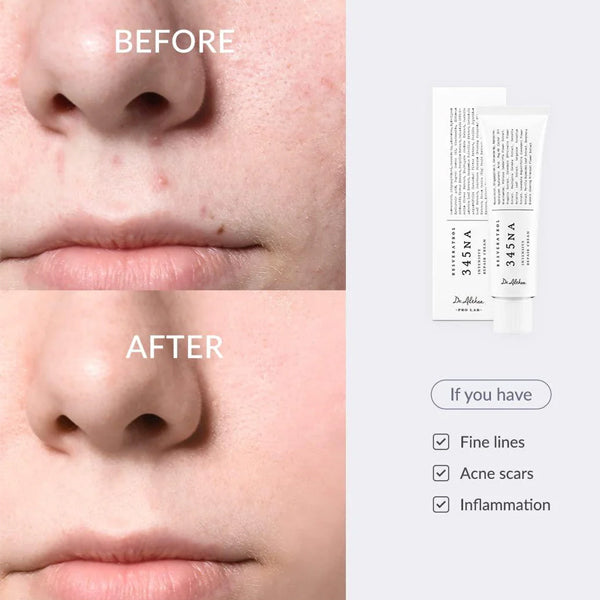Korejas kosmetika DR. ALTHEA 345 Relief Cream populārs krēms no korejas kosmētikas problemātiskai ādai pret pumpām koore.lv