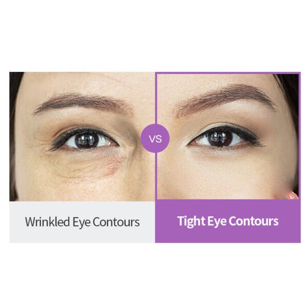 Acu krēms ar masāžas ierīci | SO BASE Collagen Lifting Vibe Eye Cream with Device - KOORE