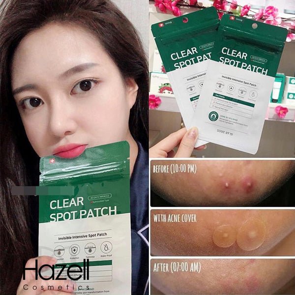 Antibakteriāli plāksteri pret izsitumiem | Some By Mi 30 Days Miracle Clear Spot Patch - KOORE