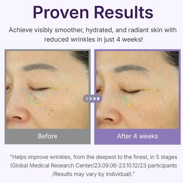 Atjaunojošs serums ar PDRN | Centellian24 360º Shot PDRN Active Serum - KOORE