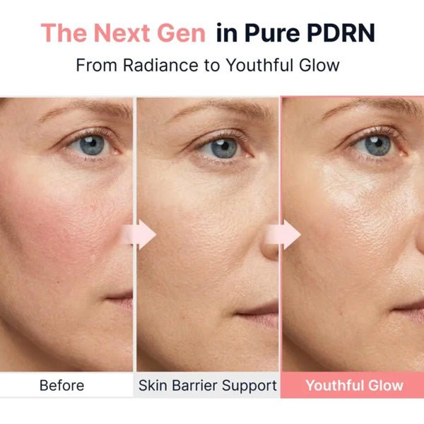 Atjaunojošs un mirdzumu piešķirošs serums ar PDRN | Sungboon Editor PDRN Pink Vitamin Glow Boosting Ampoule - KOORE