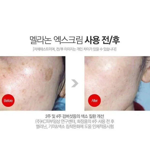 Balinošs krēms pigmentācijas novēršanai | MediPeel Melanon X Cream - KOORE