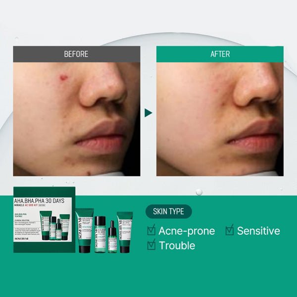 Komplekts problemātiskai ādai | Some By Mi AHA, BHA, PHA 30 Days Miracle AC SOS Kit - KOORE
