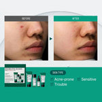 Komplekts problemātiskai ādai | Some By Mi AHA, BHA, PHA 30 Days Miracle AC SOS Kit - KOORE