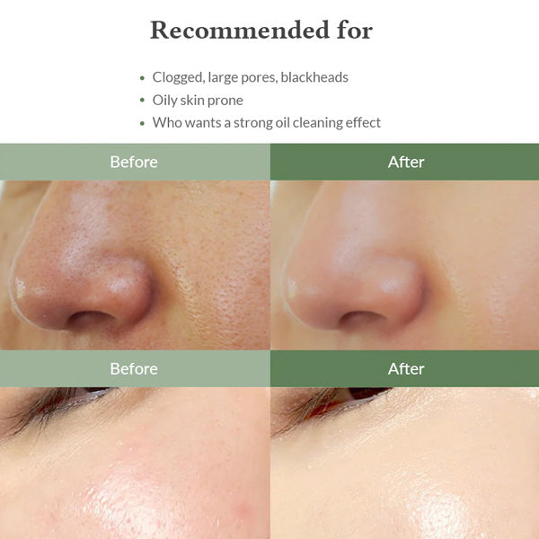Korejas sejas ādas kopšanas līdzeklis Dr. Althea Sebum Cleanser poru samazināšanai un sebuma kontrolei