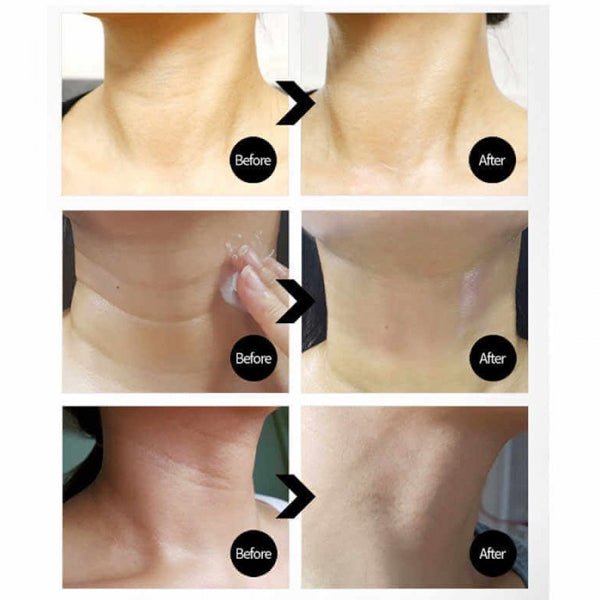 Krēms kakla ādai ar kolagēnu un peptīdiem | MediPeel Collagen Naite Thread Neck Cream Premium 2.0 - KOORE