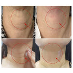 Līdzeklis kakla ādas nostiprināšanai | MediPeel Premium Peptide Naite 1000 Neck Stick - KOORE