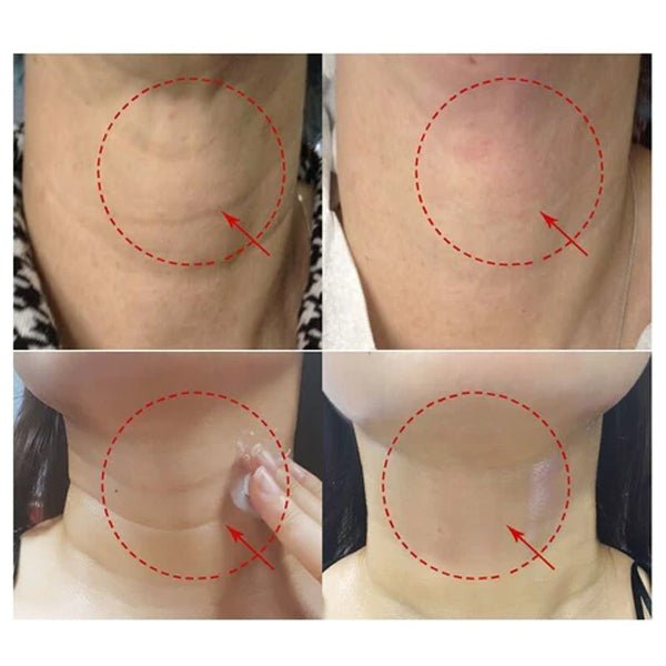 Līdzeklis kakla ādas nostiprināšanai | MediPeel Premium Peptide Naite 1000 Neck Stick - KOORE