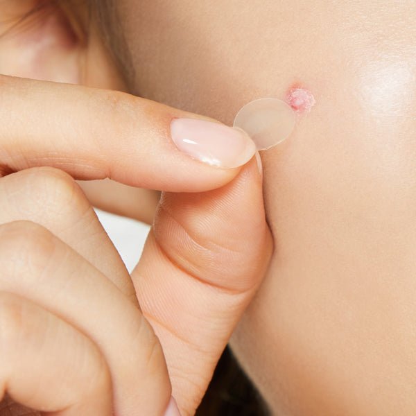 Plāksteri pūtīšu ārstēšanai - ultra plāni | COSRX Master Patch clear fit - KOORE