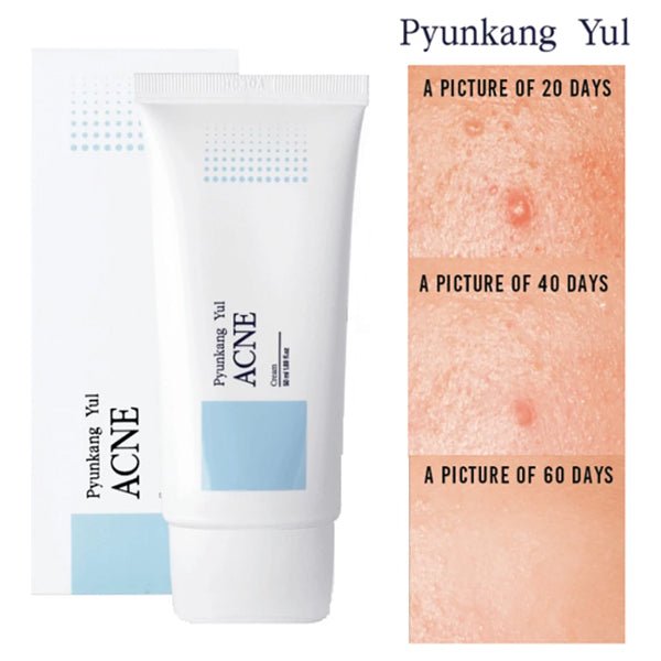 Korejas kosmētika Pyunkang Yul sejas krēms aknes un pūtīšu mazināšanai