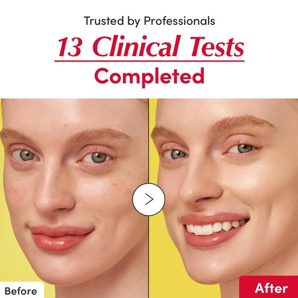 Serums ādas toņa uzlabošanai | Eqqualberry Vitamin Illuminating Serum - KOORE