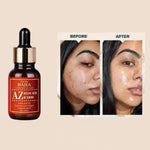 Serums ar azelaīnskābi | Cos De Baha AZ Azelaic Acid 10 Serum - KOORE