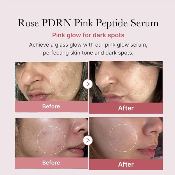 Serums ar PDRN un peptīdiem | Medicube PDRN Pink Peptide Serum - KOORE