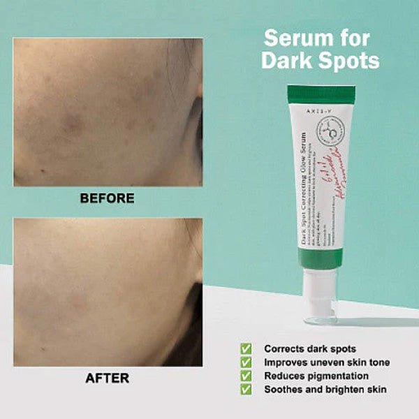 Serums pigmentācijas mazināšanai | Axis - Y Dark Spot Correcting Glow Serum - KOORE