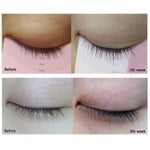 Skropstu augšanas serums | Etude My Lash Serum - KOORE