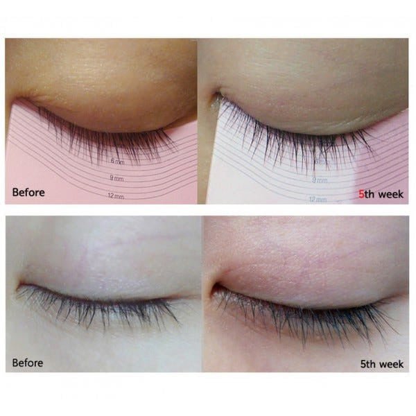 Skropstu augšanas serums | Etude My Lash Serum - KOORE