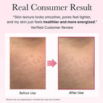 Šūnu atjaunojošs serums ar PDRN | Arencia PDRN Booster Shot - KOORE